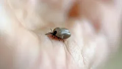 Iholla oleva punkki: miten toimia ja mihin ottaa yhteyttä pureman jälkeen